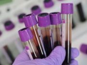 Health Research & Testing Services